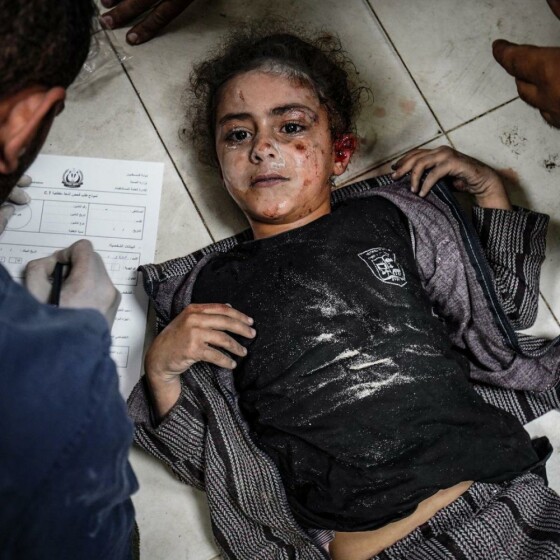 ۱۰۰ عکس از ۱۰۰ روز جنگ در غزه