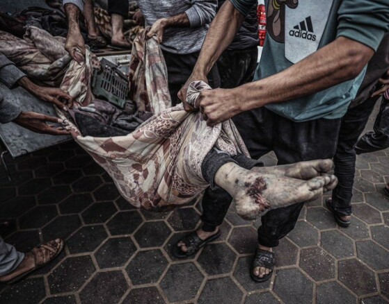 ۱۰۰ عکس از ۱۰۰ روز جنگ در غزه