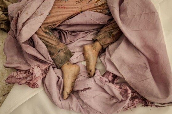 ۱۰۰ عکس از ۱۰۰ روز جنگ در غزه