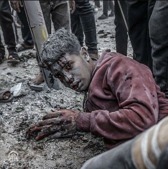 ادامه جنایات رژیم صهیونیستی در غزه